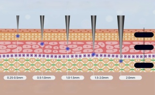 ANGEL KISS REGULOWANY STEMPEL MIKROIGŁOWY 120 TYTANOWYCH MIKROIGIEŁ